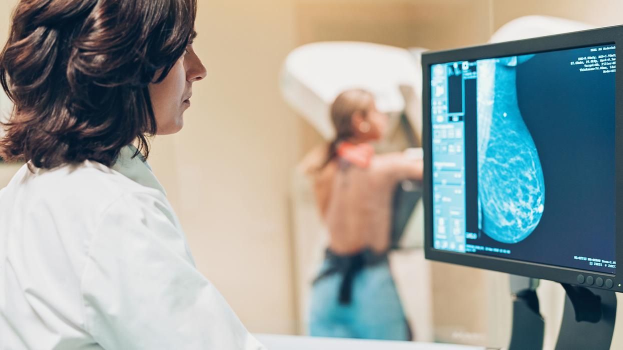 Mammography technologist looking at mammography results with patient in the background 