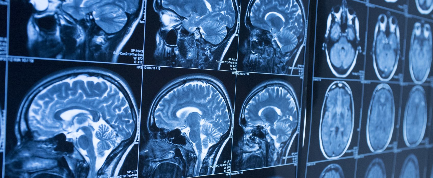 brain scan.jpg